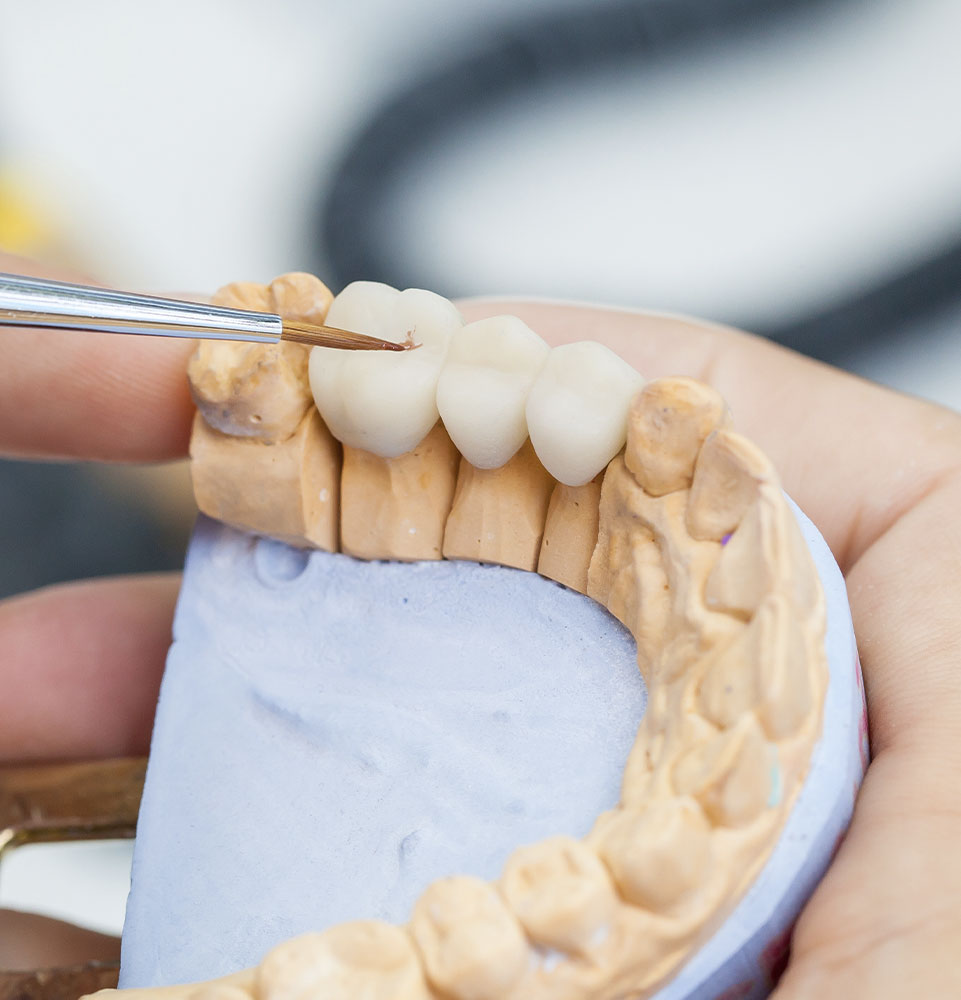 lab technician brushing dental bridge model